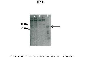 SDPR 抗体  (N-Term)