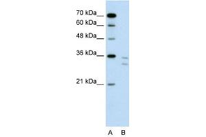 CD8B antibody used at 1 ug/ml to detect target protein. (CD8B Antikörper  (N-Term))