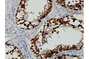 Image no. 1 for anti-Deleted in Azoospermia 1 (DAZ1) (AA 21-121) antibody (ABIN598639) (DAZ1 Antikörper  (AA 21-121))