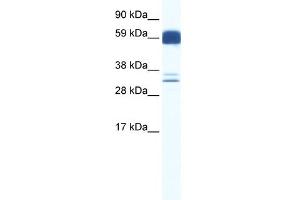 WB Suggested Anti-ZIC5 Antibody Titration:  0. (ZIC5 Antikörper  (N-Term))