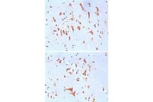 Immunohistochemical analysis of paraffin-embedded human brain tissues, showing cytoplasmic localization with DAB staining using FMR1 monoclonal antibody, clone 4G9  . (FMR1 Antikörper)
