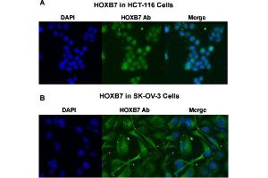 Immunofluorescent staining of (A) HCT-116 and (B) SK-OV-3 cells with HOXB7 polyclonal antibody  under 4 ug/mL working concentration. (HOXB7 Antikörper  (AA 168-217))