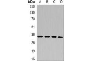 Western blot analysis of p43 expression in HepG2 (A), HT29 (B), MCF7 (C), A549 (D) whole cell lysates. (p43 Antikörper)
