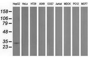 Western blot analysis of extracts (35 µg) from 9 different cell lines by using anti-PECR monoclonal antibody. (PECR Antikörper)
