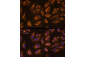 Immunofluorescence analysis of U-2 OS cells using LysRS/LysRS/KARS Rabbit pAb (ABIN6128149, ABIN6142683, ABIN6142684 and ABIN6217884) at dilution of 1:100 (40x lens). (KARS Antikörper  (AA 298-597))