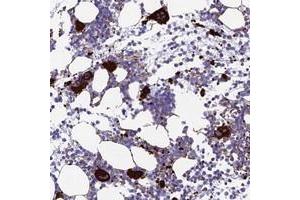 Immunohistochemical staining of human bone marrow with PSMD11 polyclonal antibody  shows strong cytoplasmic positivity in megakaryocytes. (PSMD11 Antikörper)