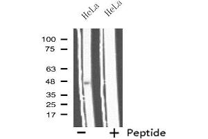 Western blot analysis of extracts from HeLa cells, using IL11RA antibody. (IL11RA Antikörper  (C-Term))