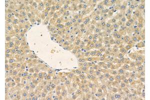 ABIN6257417 and ABIN6275853 at 1/100 staining Rat liver tissue by IHC-P. (PKC gamma Antikörper  (Internal Region))