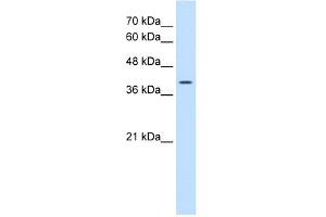 Western Blotting (WB) image for anti-Wingless-Type MMTV Integration Site Family, Member 2B (WNT2B) (N-Term) antibody (ABIN630805)