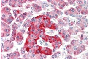 Immunohistochemistry (IHC) image for anti-Potassium Large Conductance Calcium-Activated Channel, Subfamily M, alpha Member 1 (KCNMA1) (Gln770) antibody (ABIN2879296)