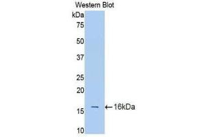 Western Blotting (WB) image for anti-Interleukin 18 Receptor 1 (IL18R1) (AA 147-255) antibody (ABIN1174878) (IL18R1 Antikörper  (AA 147-255))