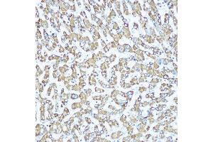 Immunohistochemistry of paraffin-embedded human liver using CPS1 Rabbit mAb (ABIN7266063) at dilution of 1:100 (40x lens). (CPS1 Antikörper)
