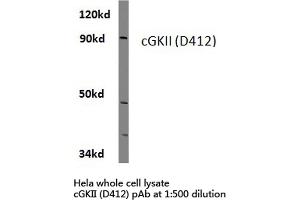 Western blot (WB) analysis of cGKii antibody  in extracts from hela cells. (PRKG2 Antikörper)