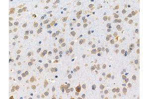 ABIN6257633 and ABIN6274769 at 1/100 staining Mouse brain tissue by IHC-P.