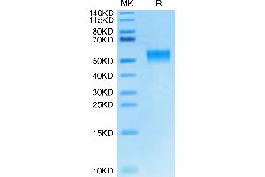 Cynomolgus LRG1 on Tris-Bis PAGE under reduced condition. (LRG1 Protein (AA 72-383) (His tag))