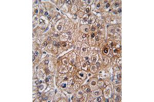 Immunohistochemistry (IHC) image for anti-Bone Morphogenetic Protein Receptor, Type II (serine/threonine Kinase) (BMPR2) (AA 28-59), (N-Term) antibody (ABIN5535544)