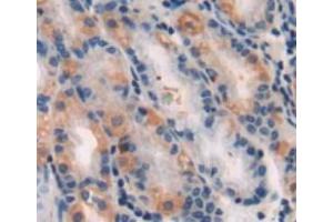 #VALUE! (Hexokinase 1 Antikörper  (AA 80-215))