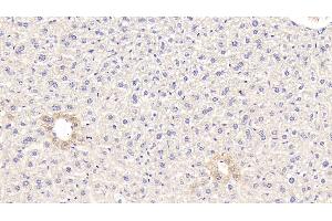 Detection of GCK in Mouse Liver Tissue using Polyclonal Antibody to Glucokinase (GCK) (GCK Antikörper  (AA 3-226))