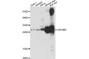 Western blot analysis of extracts of various cell lines,ing CRYBB2 antibody (ABIN1876777) at 1:1000 dilution.