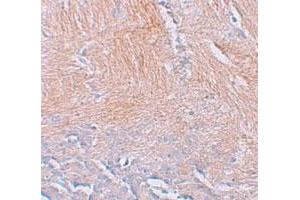 Immunohistochemical staining of human brain cells with CXXC5 polyclonal antibody  at 2. (CXXC5 Antikörper  (N-Term))
