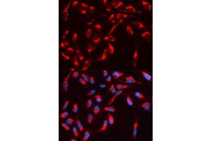 Immunofluorescence (IF) image for anti-Neural Wiskott-Aldrich syndrome protein (WASL) antibody (ABIN1875345) (Neural Wiskott-Aldrich syndrome protein (WASL) Antikörper)