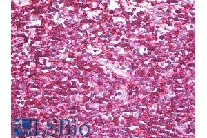 Immunohistochemistry staining of human tonsil (paraffin sections) using anti-CD45RB (clone MEM-143).