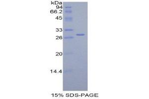 SDS-PAGE (SDS) image for Complement Factor H (CFH) (AA 975-1217) protein (His tag) (ABIN2120879) (Complement Factor H Protein (CFH) (AA 975-1217) (His tag))