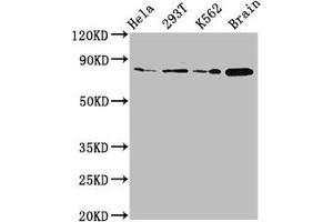 Western Blot Positive WB detected in: Hela whole cell lysate, 293T whole cell lysate, K562 whole cell lysate, Rat brain tissue All lanes: MKLN1 antibody at 2. (MKLN1 Antikörper  (AA 488-614))