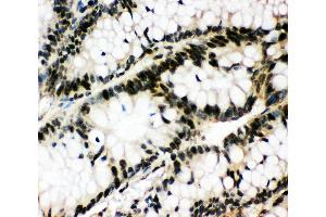 Immunohistochemistry (IHC) image for anti-Early Growth Response 1 (EGR1) (AA 23-43), (N-Term) antibody (ABIN3043997)