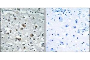Immunohistochemistry analysis of paraffin-embedded human brain tissue, using GASP1 Antibody. (GPRASP1 Antikörper  (AA 741-790))