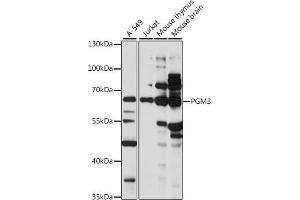 Western blot analysis of extracts of various cell lines, using PGM3 antibody (ABIN7269314) at 1:1000 dilution. (Phosphoglucomutase 3 Antikörper  (AA 1-300))