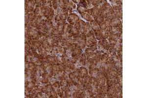 Immunohistochemical staining of human pancreas with DNAH10 polyclonal antibody  shows strong cytoplasmic positivity in exocrine glandular cells at 1:200-1:500 dilution. (DNAH10 Antikörper)