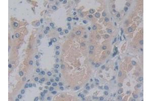 Detection of 15-LO-2 in Human Kidney Tissue using Polyclonal Antibody to 15-Lipoxygenase-2 (15-LO-2) (ALOX15B Antikörper  (AA 253-490))