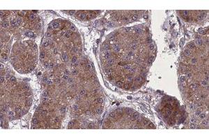 ABIN6277715 at 1/100 staining Human kidney tissue by IHC-P. (Nephrin Antikörper)