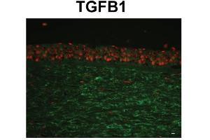 Species, Tissue/Cell Type:Human Cornea tissue (epithelium and stroma) Primary used and dilution: 1:400 (TGFBI Antikörper  (C-Term))