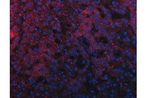 IF analysis of DEP1/PTPRJ using anti-DEP1/PTPRJ antibody (ABIN7600061).