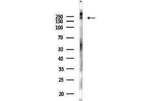 Western blot analysis of lysates from Hela cells(LPS 4h treatment), using TANC2 Antibody at 1/1000 dilution. (TANC2 Antikörper)