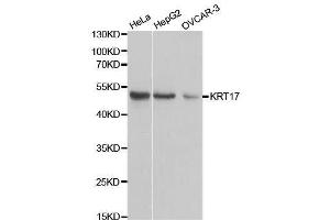 Western Blotting (WB) image for anti-Keratin 17 (KRT17) (AA 133-432) antibody (ABIN3023124)