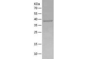 Western Blotting (WB) image for Chemokine (C-C Motif) Receptor-Like 2 (CCRL2) (AA 171-344) protein (His-IF2DI Tag) (ABIN7283849) (CCRL2 Protein (AA 171-344) (His-IF2DI Tag))