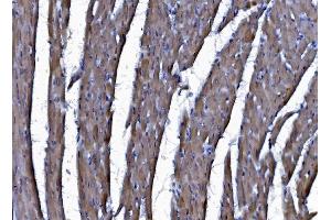 IHC analysis of CHCHD10 using anti-CHCHD10 antibody (ABIN7602507). (CHCHD10 Antikörper  (AA 80-142))