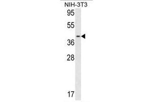 Image no. 1 for anti-Calponin 3, Acidic (CNN3) (Middle Region) antibody (ABIN452801) (CNN3 Antikörper  (Middle Region))