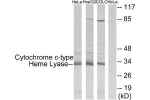 Western Blotting (WB) image for anti-Holocytochrome C Synthase (HCCS) (Internal Region) antibody (ABIN5977175) (HCCS Antikörper  (Internal Region))