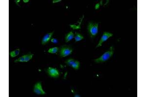 Immunofluorescence staining of U251 cells with ABIN7161318 at 1:200, counter-stained with DAPI. (Neuroligin 3 Antikörper  (AA 642-783))
