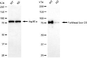 Western blotting analysis using forkhead box O3 antibody (ABIN7798646).