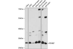 Western blot analysis of extracts of various cell lines, using PSMB7 antibody (ABIN7269594) at 1:1000 dilution. (PSMB7 Antikörper  (AA 44-200))