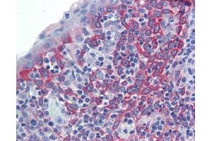 LIN7C antibody was used for immunohistochemistry at a concentration of 4-8 ug/ml. (LIN7C Antikörper)