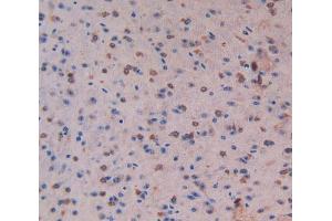 Used in DAB staining on fromalin fixed paraffin-embedded Liver tissue (MST1 Antikörper  (AA 469-704))
