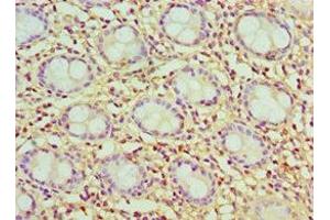 Immunohistochemistry of paraffin-embedded human colon tissue using ABIN7147595 at dilution of 1:100 (Cholecystokinin Antikörper  (AA 21-115))