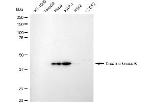 Western blotting analysis using creatine kinase B antibody (ABIN7798163). (Rekombinanter CKB Antikörper)
