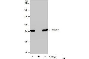IP Image Immunoprecipitation of Moesin protein from A431 whole cell extracts using 5 μg of Moesin antibody [C2C3], C-term, Western blot analysis was performed using Moesin antibody [C2C3], C-term, EasyBlot anti-Rabbit IgG  was used as a secondary reagent.